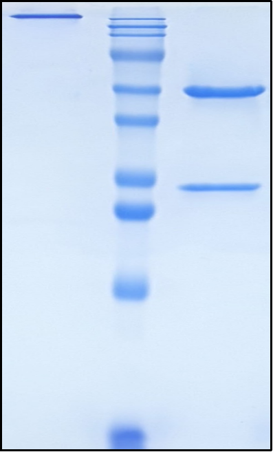 (Anetumab)Biosimilar Reference Antibody(MSLN)