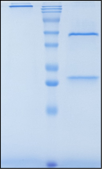 (Astegolimab)Biosimilar Reference Antibody(IL1RL1/ST2)