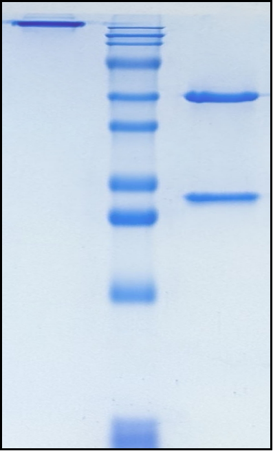(Dalotuzumab)Biosimilar Reference Antibody(IGF1R/CD221)