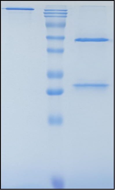 (Ersodetug)Biosimilar Reference Antibody(INSR/CD220)