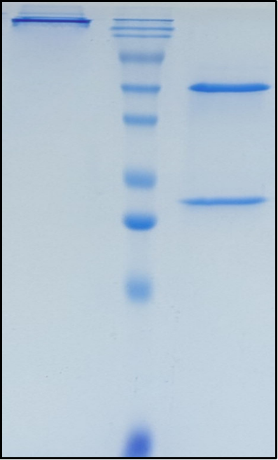 (Ginisortamab)Biosimilar Reference Antibody(GREM1)