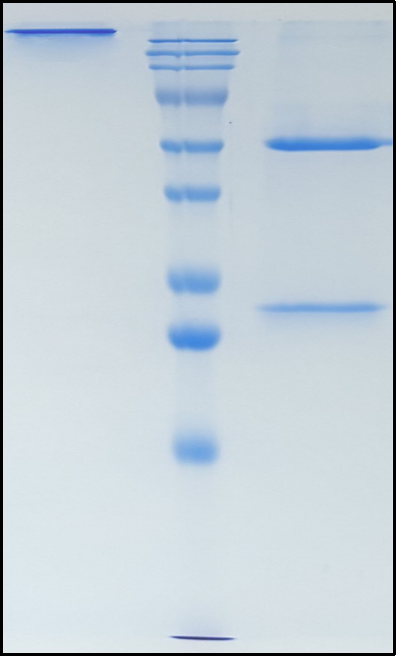 (Lafuvitug)Biosimilar Reference Antibody(HIV-1 gp120)