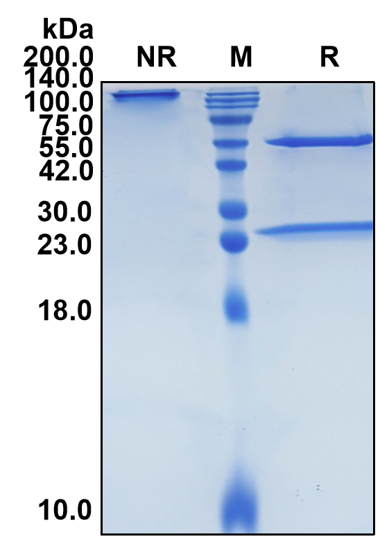 (Narlumosbart)Biosimilar Reference Antibody(TNFSF11/CD254/RANKL/TRANCE/OPGL/ODF)(CAS NO:2646587-68-8)