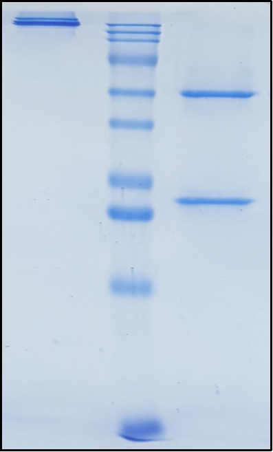 (Nelmastobart)Biosimilar Reference Antibody(BTN1A1)