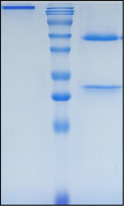(Omalizumab)Biosimilar Reference Antibody(IGHE)