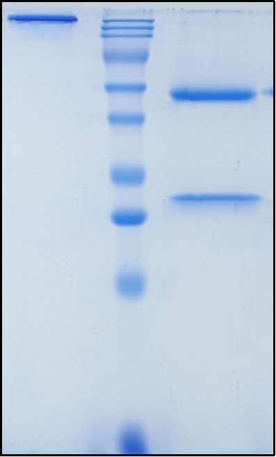 (Plozalizumab)Biosimilar Reference Antibody(CCR2/CD192)