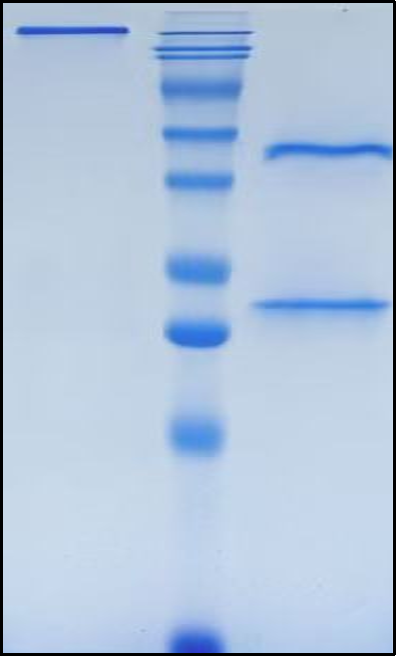 (Ponezumab)Biosimilar Reference Antibody(APP)