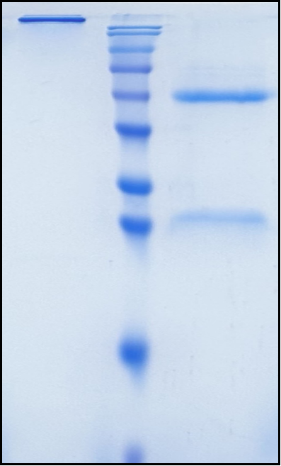 (Porgaviximab)Biosimilar Reference Antibody(Zaire Ebolavirus Glycoprotein)