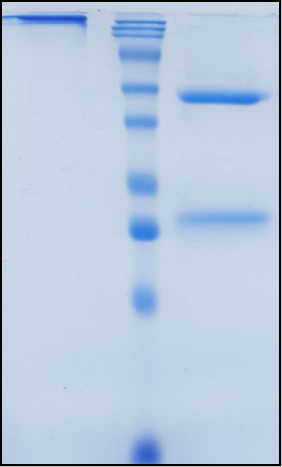 (Puxitatug)Biosimilar Reference Antibody(VTCN1/B7H4)