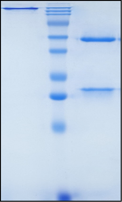 (Raludotatug)Biosimilar Reference Antibody(CDH6)