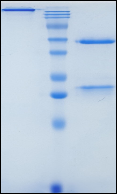 (Ranevetmab)Biosimilar Reference Antibody(NGFB)