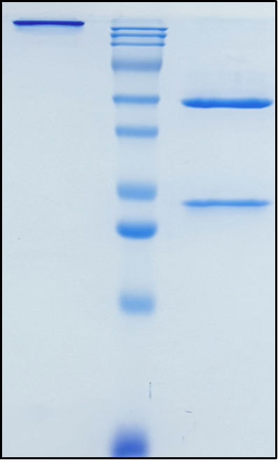 (Seniprutug)Biosimilar Reference Antibody(TRBV9)