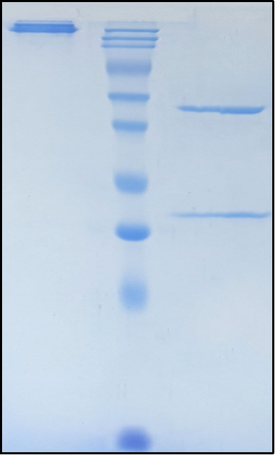 (Sofituzumab)Biosimilar Reference Antibody(MUC16/CA125)