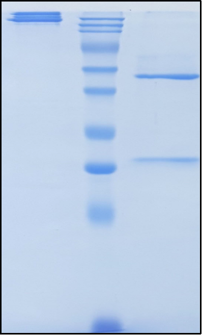 (Stamulumab)Biosimilar Reference Antibody(MSTN/GDF8)