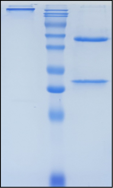 (Tregalizumab)Biosimilar Reference Antibody(CD4)