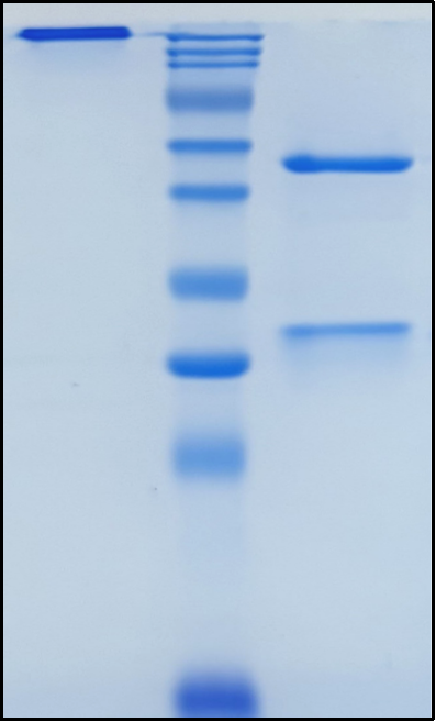 (Trinbelimab)Biosimilar Reference Antibody(RhD/CD240D/RhPI)