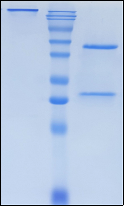 (Ustekinumab)Biosimilar Reference Antibody(IL12B/CLMFp40)
