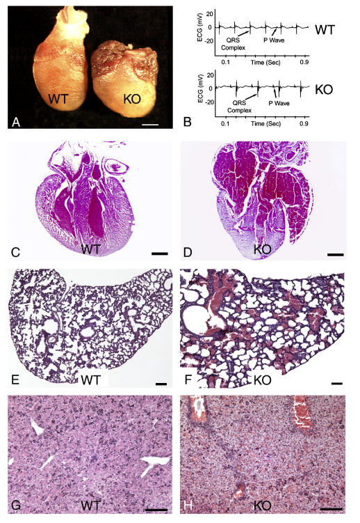 酪氨酸蛋白激酶受体 EPHA3