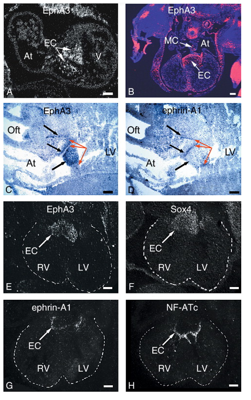 酪氨酸蛋白激酶受体 EPHA3