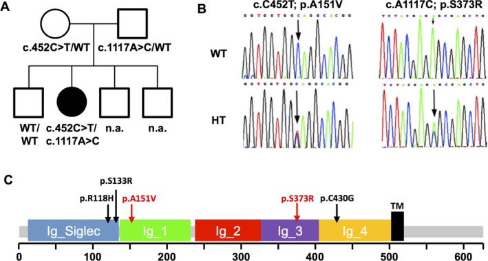 髓鞘相关糖蛋白MAG