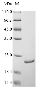 Recombinant Acholeplasma laidlawii Holo-[acyl-carrier-protein] synthase(acpS)