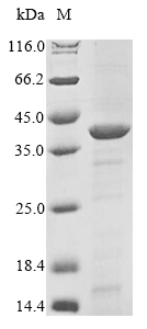 Recombinant Acinetobacter baumannii UDP-3-O-acyl-N-acetylglucosamine deacetylase(lpxC)
