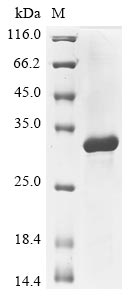 Recombinant Anemonia sulcata GFP-like non-fluorescent chromoprotein FP595