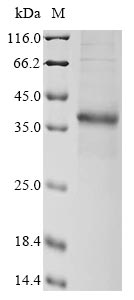 Recombinant Anemonia sulcata GFP-like non-fluorescent chromoprotein FP595