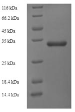 Recombinant Apium graveolens Major allergen Api g 1, isoallergen 2