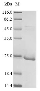 Recombinant Arabidopsis thaliana E3 SUMO-protein ligase SIZ1(SIZ1),partial