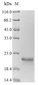 Recombinant Arabidopsis thaliana Ubiquitin-conjugating enzyme E2 11(UBC11)
