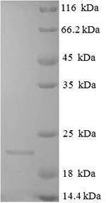 Recombinant Arachis hypogaea Conglutin-7