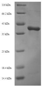 Recombinant Autographa californica nuclear polyhedrosis virus Viral cathepsin(VCATH)