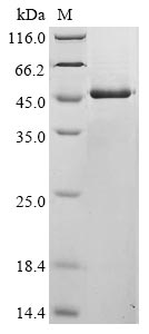 Recombinant Avian infectious bronchitis virus Nucleoprotein(N)