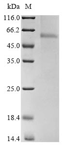 Recombinant Avian infectious bronchitis virus Nucleoprotein(N)
