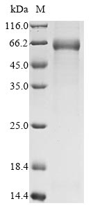 Recombinant Avian infectious bronchitis virus Nucleoprotein(N)