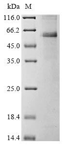 Recombinant Avian infectious bronchitis virus Nucleoprotein(N)