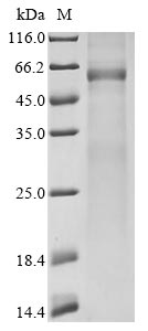 Recombinant Avian infectious bronchitis virus Nucleoprotein(N)