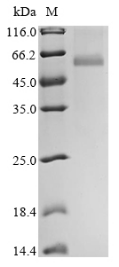 Recombinant Avian infectious bronchitis virus Nucleoprotein(N)
