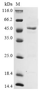 Recombinant Avian infectious bronchitis virus Nucleoprotein(N)