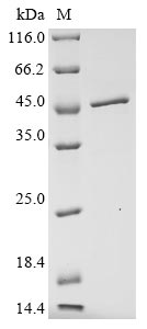 Recombinant Avian infectious bronchitis virus Nucleoprotein(N)