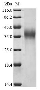 Recombinant Avian infectious bronchitis virus Spike glycoprotein(S),partial