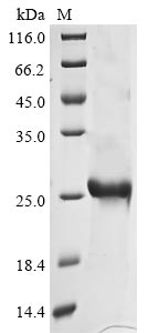 Recombinant Avian infectious bronchitis virus Spike glycoprotein(S),partial