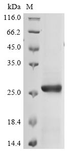 Recombinant Avian infectious bronchitis virus Spike glycoprotein(S),partial