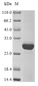 Recombinant Bacillus subtilis 4-phosphopantetheinyl transferase ffp(ffp)