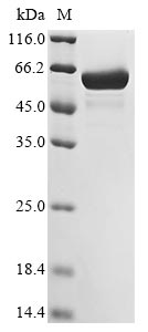 Recombinant Bacillus subtilis L-arabinose isomerase(araA)