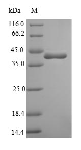 Recombinant Bacillus subtilis Penicillin-binding protein 4(pbpD),partial