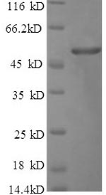 Recombinant Bacillus thuringiensis subsp. Pesticidal crystal protein cry1Ac(cry1Ac),partial
