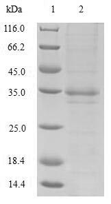 Recombinant Bordetella pertussis Serotype 3 fimbrial subunit(fim3)