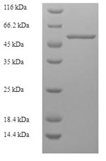 Recombinant Borrelia burgdorferi Flagellar filament 41 kDa core protein(fla)